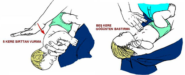 bebeğin yabancı cisim yutması