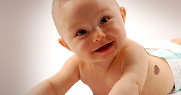 doğum lekesi neden olur