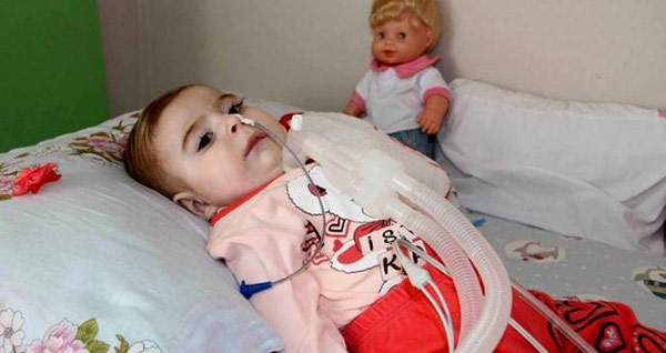 sma gevşek bebek