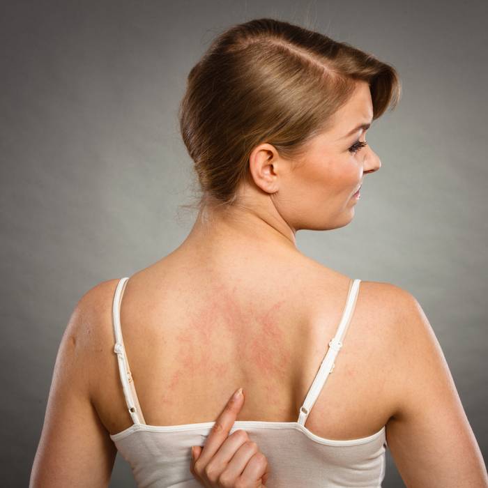 Hamileyken Hamileliğe Alerjisi Olduğunu Öğrendi!