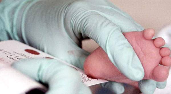 bebeklerde topuk kanı testi