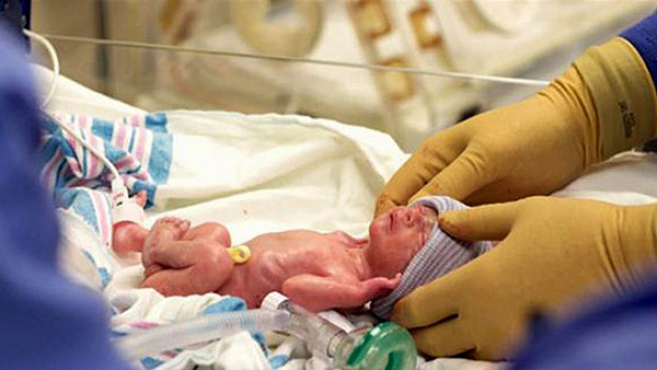 Bebeklerde düşük doğum ağırlığı nedenleri