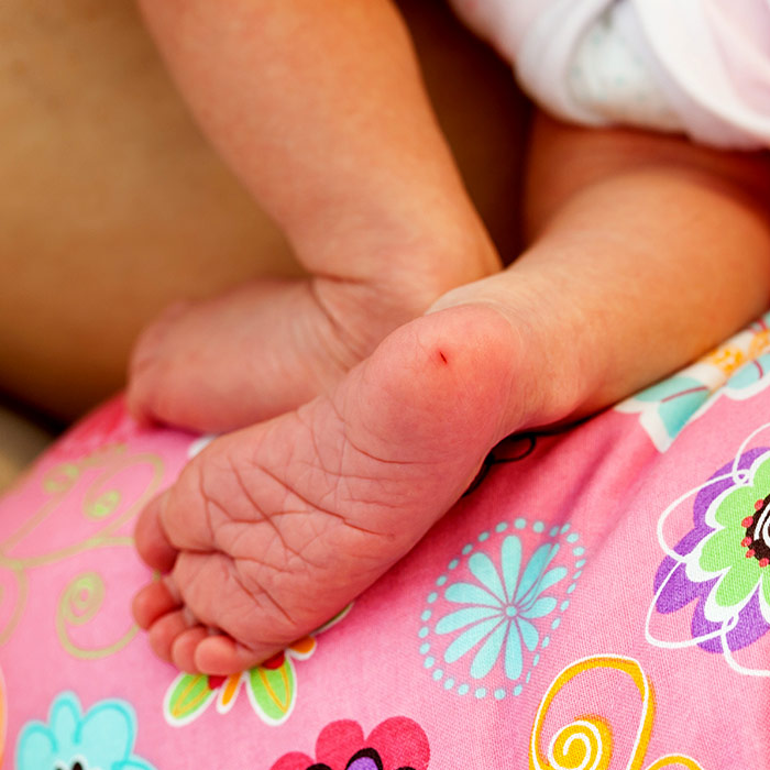 Topuk Kanı Testi Ne Zaman Yapılmalı?