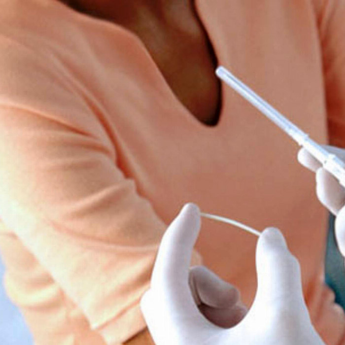 Gebelikten Korunmak için En Çok Bu Yöntem Kullanılıyor