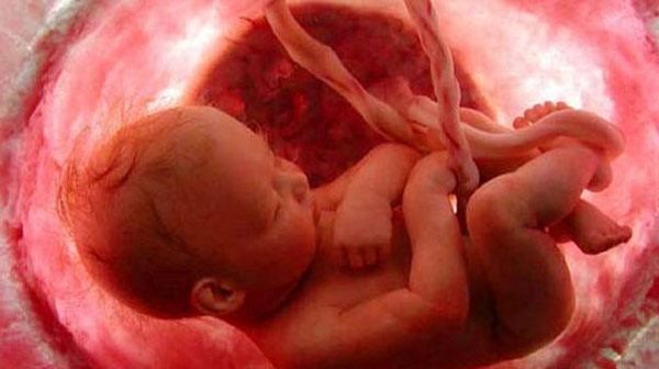 Doğum öncesi genetik tanı için prenatal