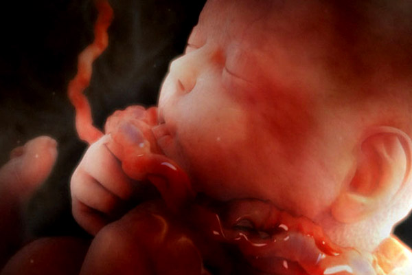 kordon dolanması nedir