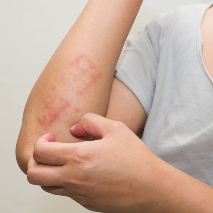 Hamileliğe Karşı Alerjiniz Olabileceğini Biliyor Muydunuz?