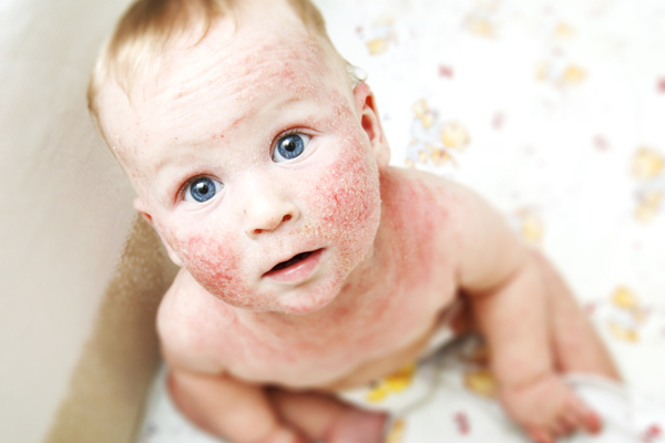 yenidoğan bebeğin cilt bakımında dikkat edilmesi gerekenler