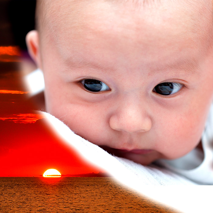Gün Batımı Sendromu'nun (hidrosefali) Belirtileri