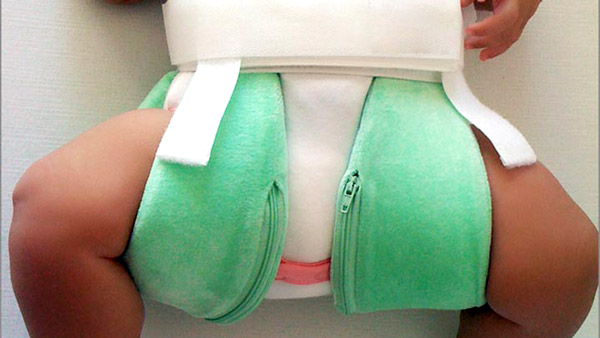 kalça çıkıklığı tanısı