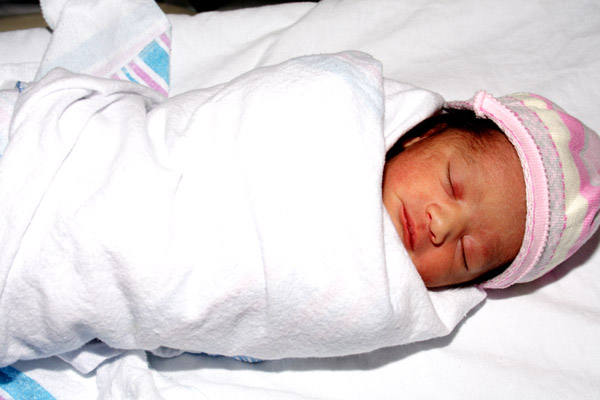 bebekte kalça çıkıklığı sıkı kundak