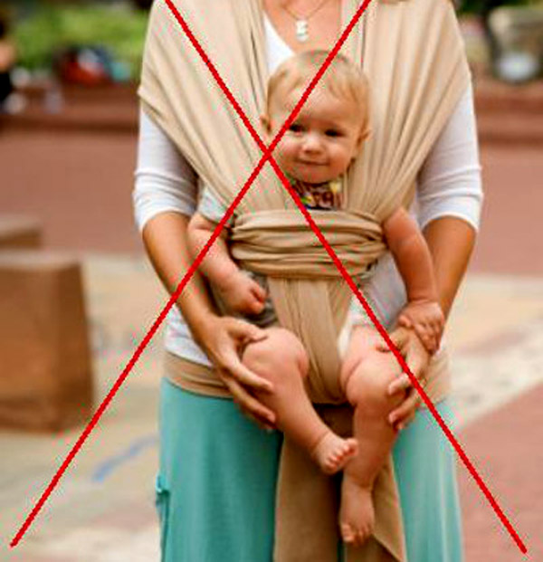 kalça çıkığı nedeni hatalı taşıma 