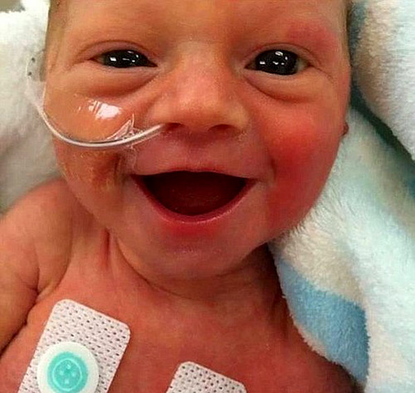 erken doğan bebeklerin yaşama - Prematüre bebeklerin yaşama oranı