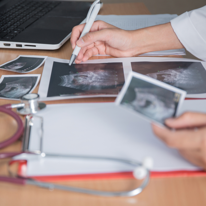 Boş Gebelik Nasıl Anlaşılır?