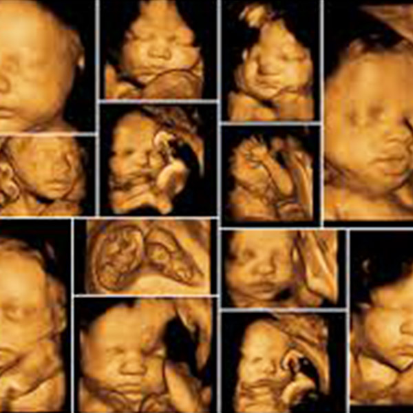 40'Tan Fazla Kadına Aynı Ultrason Görüntüsü Verildi!