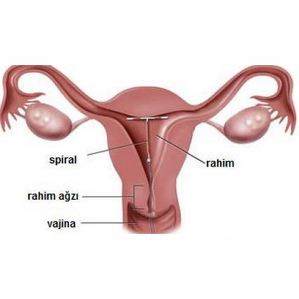 Spiral Doğumdan Sonra Ne Zaman Takılabilir?