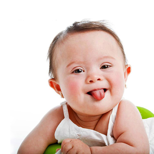 Doğumsal Kusurlar Hakkında Bunları Biliyor Musunuz?