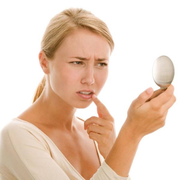 Hamilelikte Dudak Uçuğu Nasıl Tedavi Edilir?