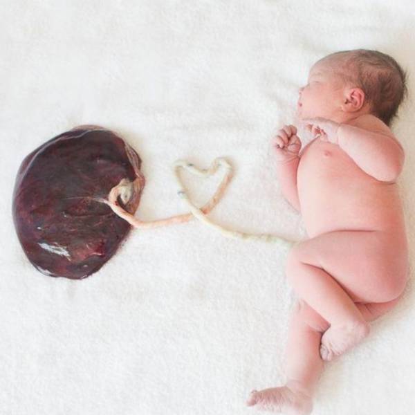 Plasenta Yaşlanması (kireçlenmesi) Nedir?